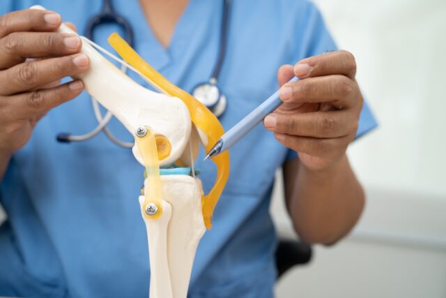 Osteoarthritis,Of,The,Knee,,Doctor,Holding,Human,Knee,Joint,Orthopedic rodillas