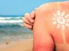 ¿Por qué la quemadura de sol aparece tardíamente? quemadura