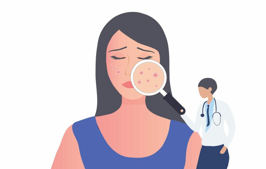 problemas en la piel