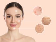 Problemas en la piel: cómo solucionarlos Problemas en la piel