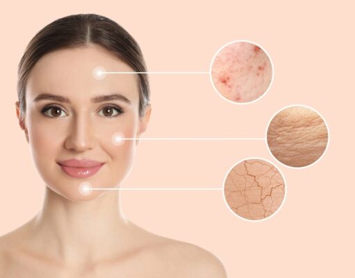 Problemas en la piel: cómo solucionarlos Problemas en la piel