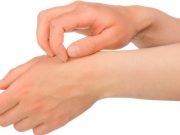 4 cambios en la piel que no hay que ignorar