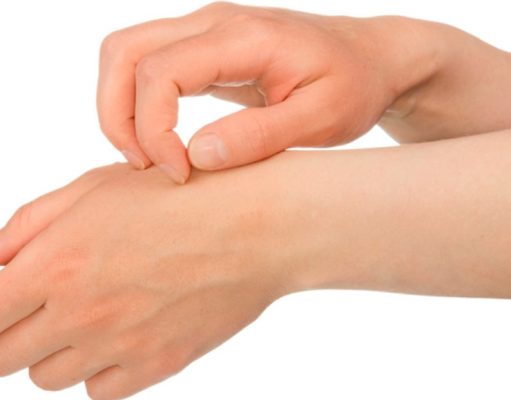 4 cambios en la piel que no hay que ignorar