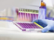 4 pruebas para detectar cáncer que podrían salvarle la vida