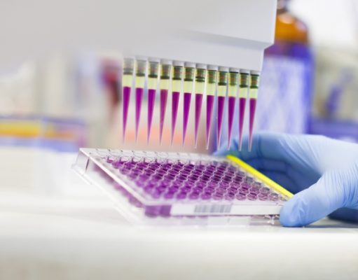 4 pruebas para detectar cáncer que podrían salvarle la vida