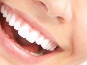 5 alimentos para tener los dientes blancos