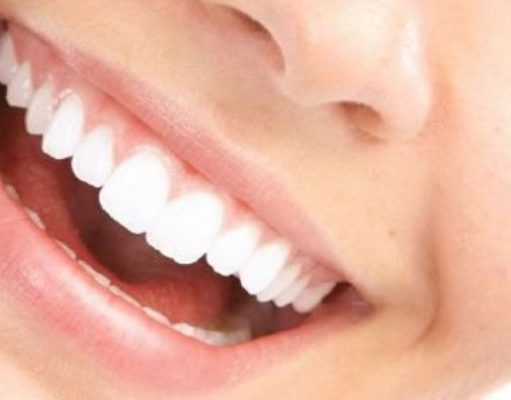 5 alimentos para tener los dientes blancos