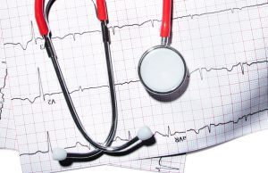 5 estudios cardíacos que podrían salvarle la vida Revista Selecciones