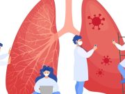 Afecciones pulmonares que debes conocer: atelectasia y enfisema