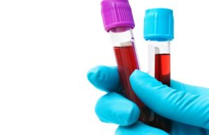 Hepatitis: ¿quién corre riesgo? Revista Selecciones