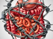 Intestino irritable hereditario