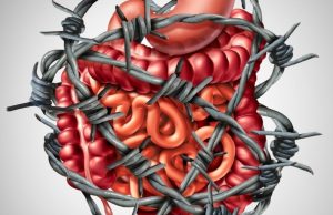 Intestino irritable hereditario Revista Selecciones