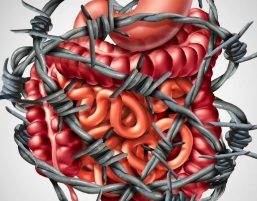 Intestino irritable hereditario