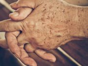 La solución contra las manchas de la edad