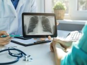 Para conocerte mejor, pulmón