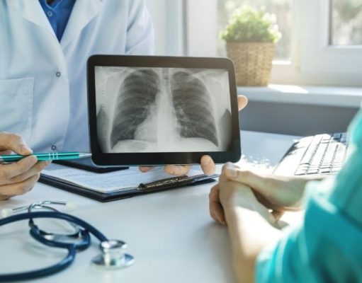 Para conocerte mejor, pulmón