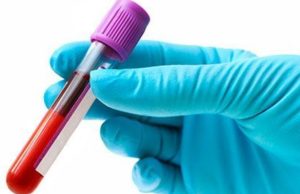 Por qué coagula la sangre Revista Selecciones