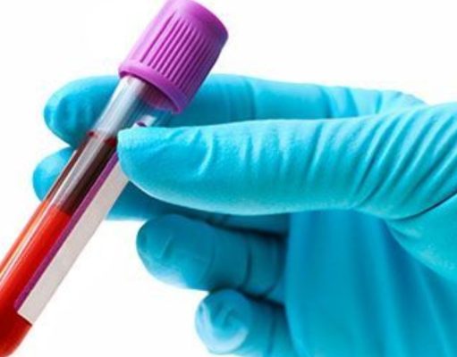 Por qué coagula la sangre