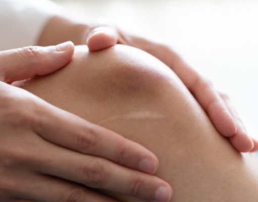 ¿Por qué con la edad salen más moretones?