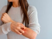 ¿Qué son los sarpullidos y cómo curarlos?