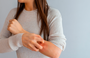 ¿Qué son los sarpullidos y cómo curarlos? Revista Selecciones