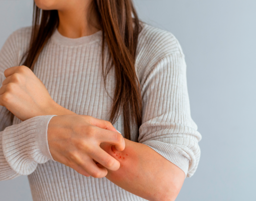 ¿Qué son los sarpullidos y cómo curarlos?