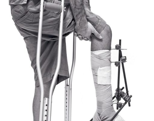 Solo, herido, casi muerto