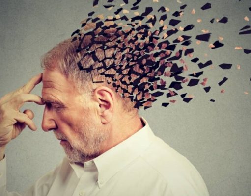 ¿Qué es la enfermedad de alzheimer?