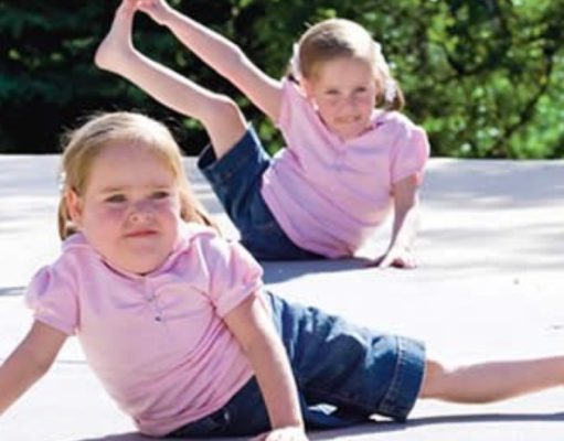 Siamesas: una historia de lucha y amor Siamesas: una historia de lucha y amor