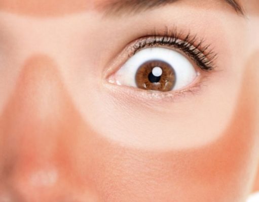 ¡Alerta sol! Cómo evitar y aliviar quemaduras de sol