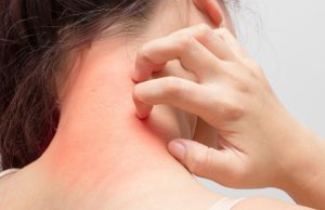 ¿Cuáles son los síntomas comunes de la alergia? Revista Selecciones