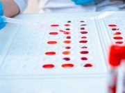 ¿El tipo de sangre podría aumentar el riesgo de contraer COVID-19?