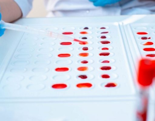 ¿El tipo de sangre podría aumentar el riesgo de contraer COVID-19?