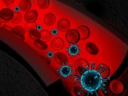 La sepsis: qué es y cuáles son sus síntomas