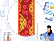 Nuevos descubrimientos sobre el colesterol