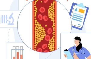 Nuevos descubrimientos sobre el colesterol Revista Selecciones