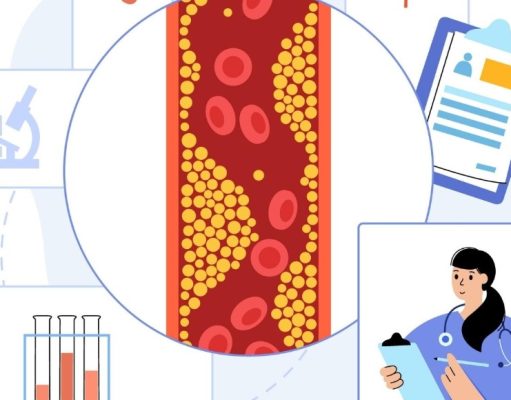 Nuevos descubrimientos sobre el colesterol