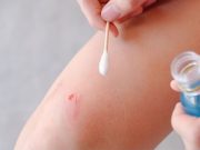 ¿Por qué se asocia el agua oxigenada con la desinfección? ¿Por qué se asocia el agua oxigenada con la desinfección?