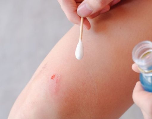 ¿Por qué se asocia el agua oxigenada con la desinfección? ¿Por qué se asocia el agua oxigenada con la desinfección?