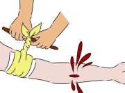 ¿Cómo actuar ante un sangrado profuso?