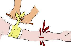 ¿Cómo actuar ante un sangrado profuso? Revista Selecciones