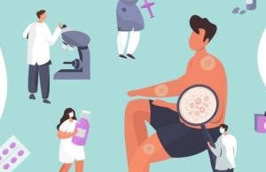 ¿Qué es la psoriasis y cómo se manifiesta? Revista Selecciones