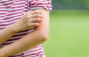 Conozca los insectos que transmiten enfermedades Revista Selecciones