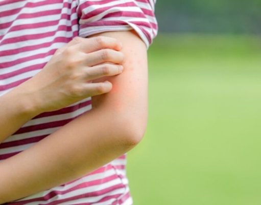 Conozca los insectos que transmiten enfermedades