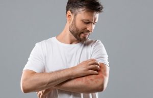 Tratamientos caseros para aliviar los eccemas Revista Selecciones