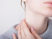 Adiós, verrugas Cómo eliminar esas feas protuberancias cutáneas y olvidar a las verrugas.