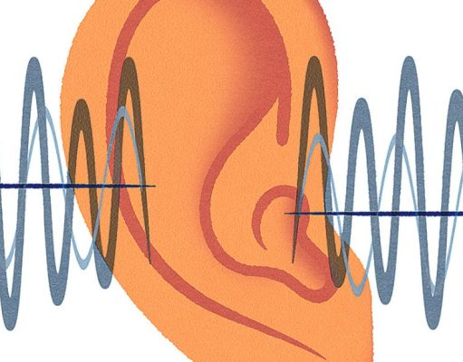 ¿Se puede revertir la pérdida auditiva? se puede revertir la perdida auditiva